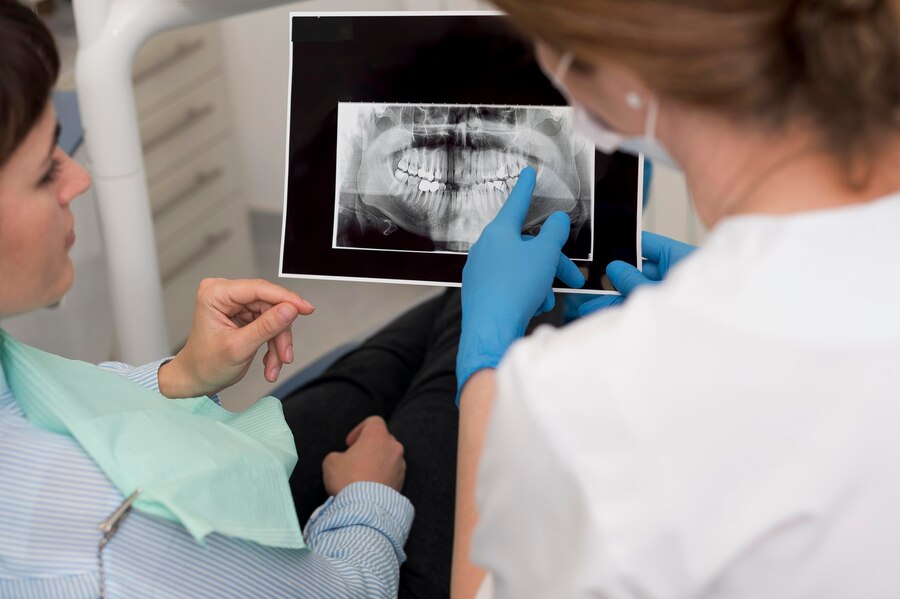 Diş Röntgeni Nedir? Diş Röntgeni Nasıl Çekilir?
